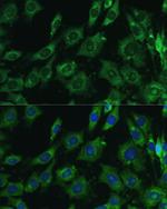 Galectin 3 Antibody in Immunocytochemistry (ICC/IF)