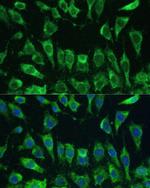 Galectin 3 Antibody in Immunocytochemistry (ICC/IF)