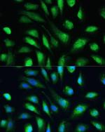 Galectin 3 Antibody in Immunocytochemistry (ICC/IF)