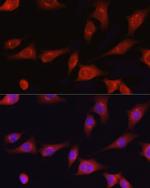 COL1A1 Antibody in Immunocytochemistry (ICC/IF)