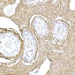 COL1A1 Antibody in Immunohistochemistry (Paraffin) (IHC (P))