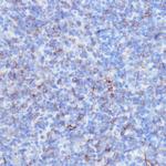 NOTCH3 Antibody in Immunohistochemistry (Paraffin) (IHC (P))