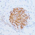 NOTCH3 Antibody in Immunohistochemistry (Paraffin) (IHC (P))