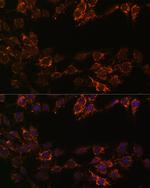 MAOA Antibody in Immunocytochemistry (ICC/IF)