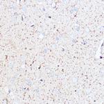 MAOA Antibody in Immunohistochemistry (Paraffin) (IHC (P))