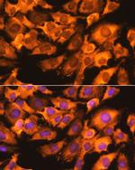 RPS3 Antibody in Immunocytochemistry (ICC/IF)