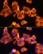 RPS3 Antibody in Immunocytochemistry (ICC/IF)