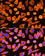 RPS3 Antibody in Immunocytochemistry (ICC/IF)