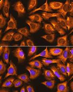 RPS3 Antibody in Immunocytochemistry (ICC/IF)