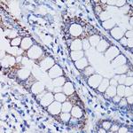 TFAM Antibody in Immunohistochemistry (Paraffin) (IHC (P))