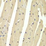 USP7 Antibody in Immunohistochemistry (Paraffin) (IHC (P))