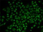 RAD54L2 Antibody in Immunocytochemistry (ICC/IF)