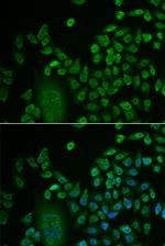 LSM4 Antibody in Immunocytochemistry (ICC/IF)