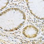 LSM4 Antibody in Immunohistochemistry (Paraffin) (IHC (P))