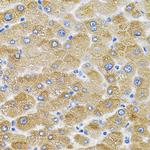 MFN2 Antibody in Immunohistochemistry (Paraffin) (IHC (P))