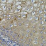 MFN2 Antibody in Immunohistochemistry (Paraffin) (IHC (P))