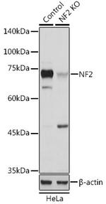 NF2 Antibody in Western Blot (WB)