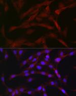 PKC beta-1,2 Antibody in Immunocytochemistry (ICC/IF)