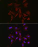 PKC beta-1,2 Antibody in Immunocytochemistry (ICC/IF)