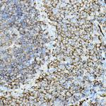 PKC beta-1,2 Antibody in Immunohistochemistry (Paraffin) (IHC (P))