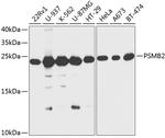 PSMB2 Antibody in Western Blot (WB)