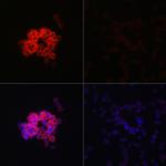 MDA5 Antibody in Immunocytochemistry (ICC/IF)