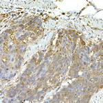 MDA5 Antibody in Immunohistochemistry (Paraffin) (IHC (P))