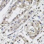 Carbonic Anhydrase IX Antibody in Immunohistochemistry (Paraffin) (IHC (P))