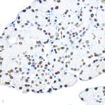 NR5A2 Antibody in Immunohistochemistry (Paraffin) (IHC (P))