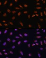 SARNP Antibody in Immunocytochemistry (ICC/IF)