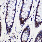 SARNP Antibody in Immunohistochemistry (Paraffin) (IHC (P))