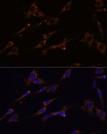 RPL7A Antibody in Immunocytochemistry (ICC/IF)