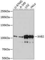 XAB2 Antibody in Western Blot (WB)