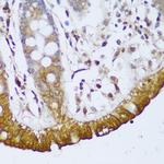 GCC2 Antibody in Immunohistochemistry (Paraffin) (IHC (P))