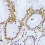 GCC2 Antibody in Immunohistochemistry (Paraffin) (IHC (P))