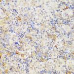 GCC2 Antibody in Immunohistochemistry (Paraffin) (IHC (P))