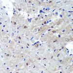 PSME4 Antibody in Immunohistochemistry (Paraffin) (IHC (P))