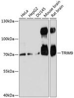 TRIM9 Antibody in Western Blot (WB)