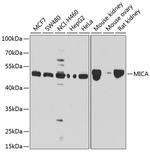 MICA Antibody in Western Blot (WB)