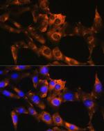 APRT Antibody in Immunocytochemistry (ICC/IF)