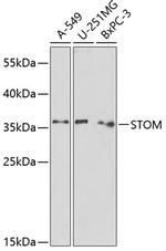 Stomatin Antibody in Western Blot (WB)