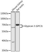 Glypican 3 Antibody in Western Blot (WB)