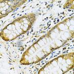 PGK1 Antibody in Immunohistochemistry (Paraffin) (IHC (P))