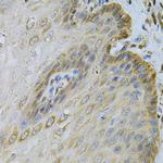 PGK1 Antibody in Immunohistochemistry (Paraffin) (IHC (P))