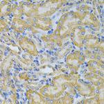 PGK1 Antibody in Immunohistochemistry (Paraffin) (IHC (P))