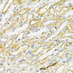 SULT2A1 Antibody in Immunohistochemistry (Paraffin) (IHC (P))