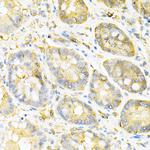 SULT2A1 Antibody in Immunohistochemistry (Paraffin) (IHC (P))