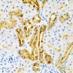 SULT2A1 Antibody in Immunohistochemistry (Paraffin) (IHC (P))