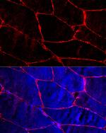 Dystrophin Antibody in Immunocytochemistry (ICC/IF)