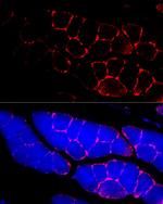 Dystrophin Antibody in Immunocytochemistry (ICC/IF)